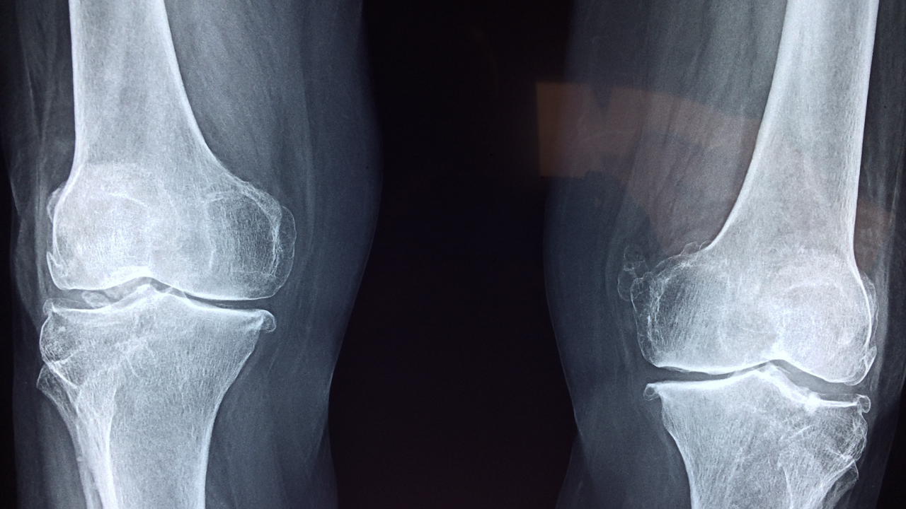 x ray